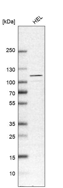 Analysis in human cell line HEL.