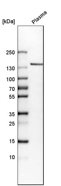 Analysis in human plasma.