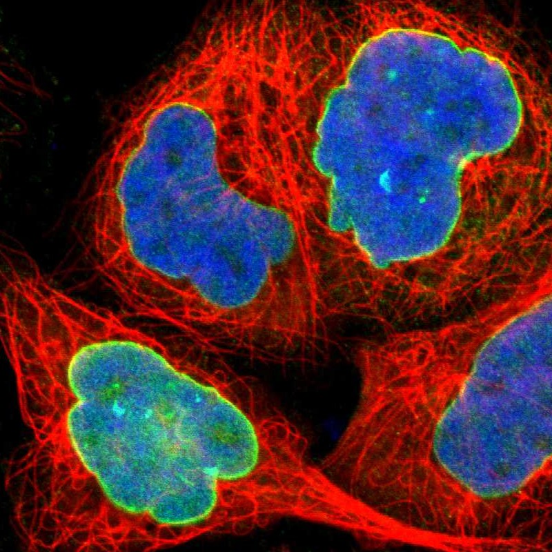 Staining of human cell line A-431 shows positivity in nuclear membrane.