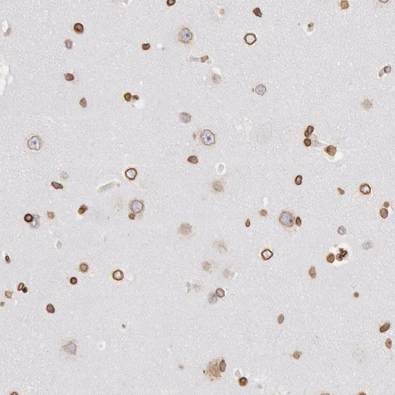 Immunohistochemistry-Paraffin NSUN2 Antibody