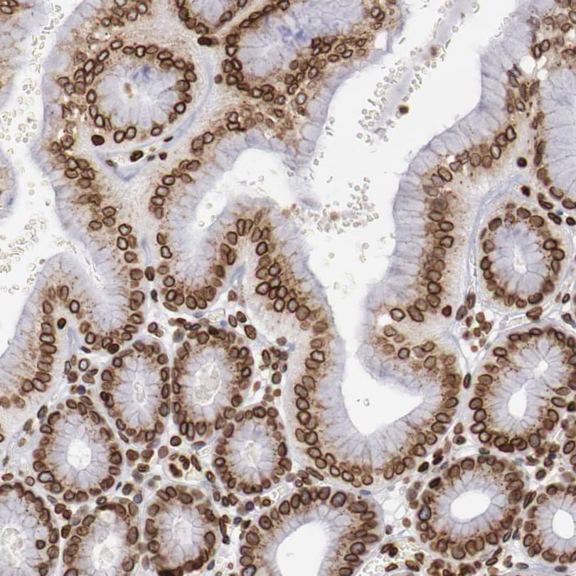 Immunohistochemistry-Paraffin NSUN2 Antibody