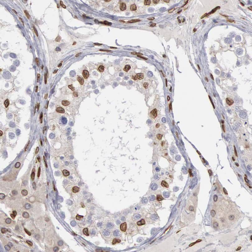 Immunohistochemistry-Paraffin NSUN2 Antibody