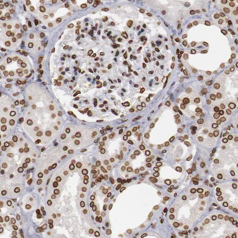 Staining of human kidney shows moderate to strong positivity in nuclear membrane in cells in tubules and cells in glomeruli.