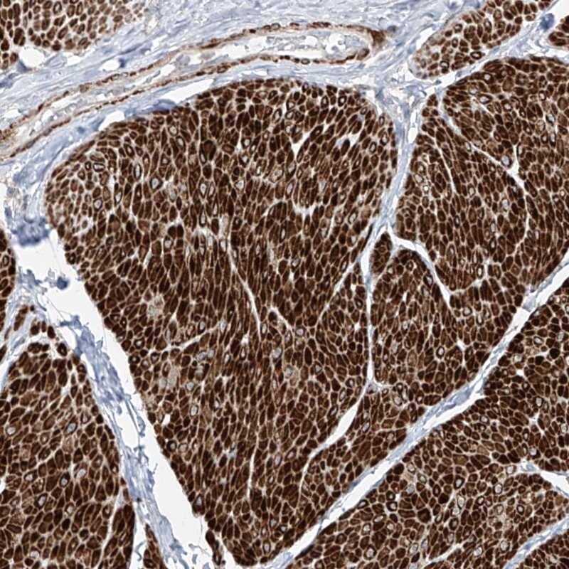 Staining of human smooth muscle shows strong cytoplasmic positivity in smooth muscle cells.