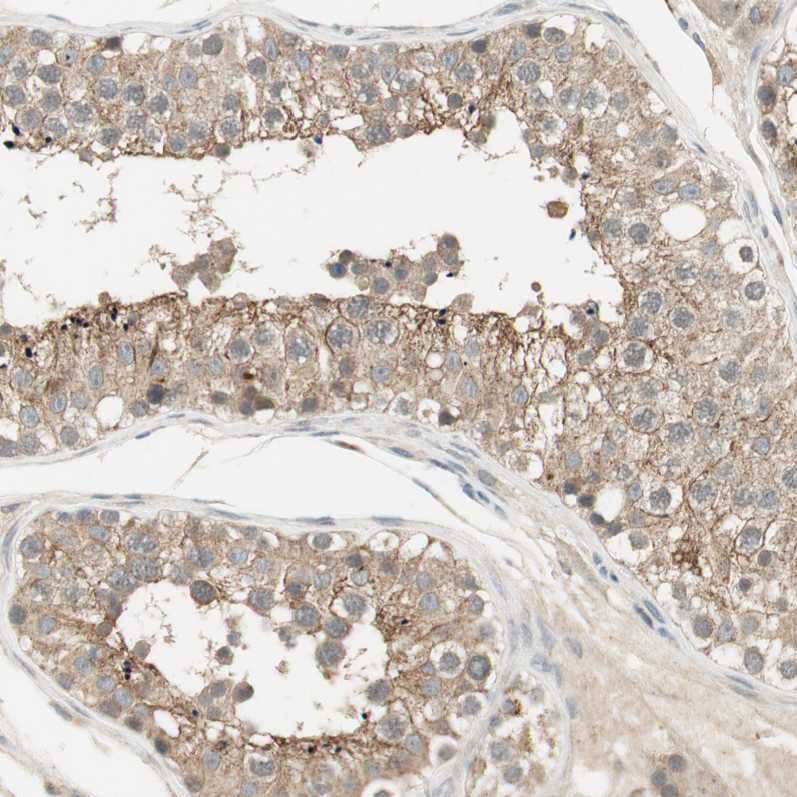 Staining of human testis shows weak to moderate cytoplasmic positivity in cells in seminiferous ducts.
