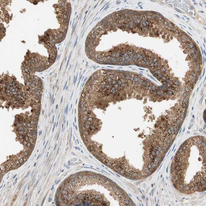 Staining of human prostate shows strong granular cytoplasmic positivity in glandular cells.