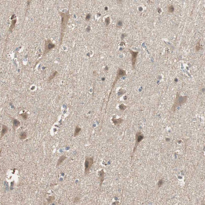 Staining of human cerebral cortex shows weak cytoplasmic positivity in neurons.