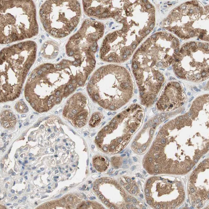 Staining of human kidney shows moderate granular cytoplasmic positivity in cells in tubules.