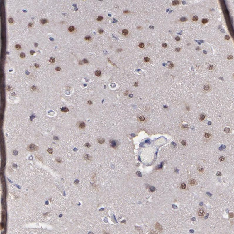 Staining of human cerebral cortex shows moderate cytoplasmic and nuclear positivity in neurons.