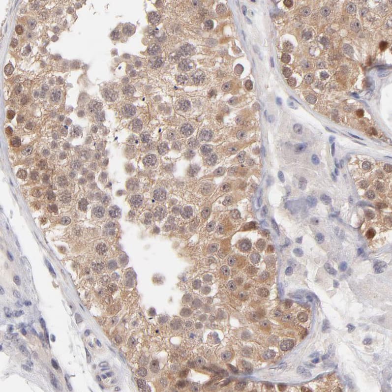 Staining of human testis shows moderate cytoplasmic and nuclear positivity in cells in seminiferous ducts.