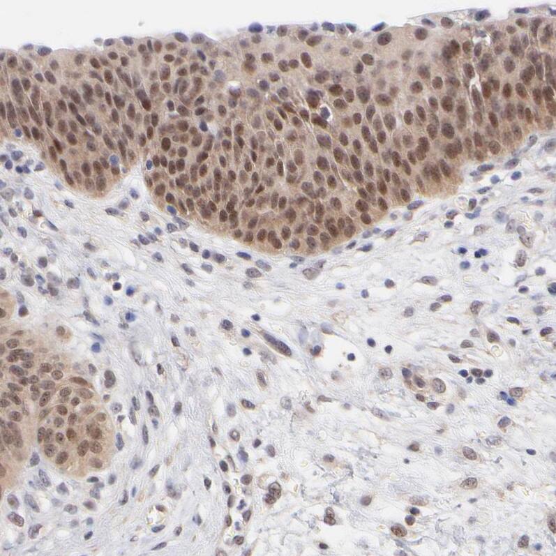 Staining of human urinary bladder shows moderate nuclear and cytoplasmic positivity in urothelial cells.