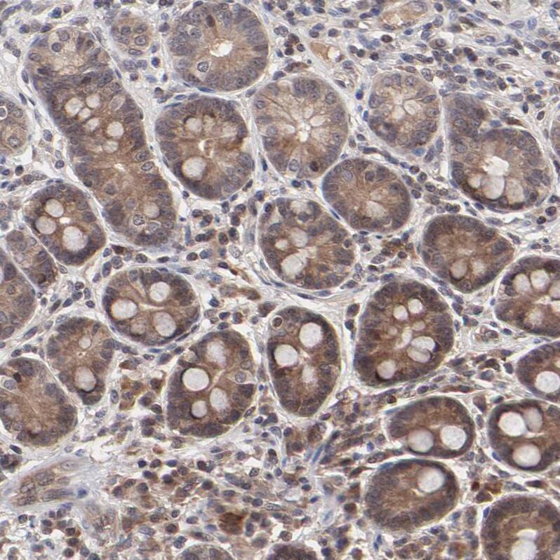 Immunohistochemistry-Paraffin UbcH8/Ube2L6 Antibody - BSA Free