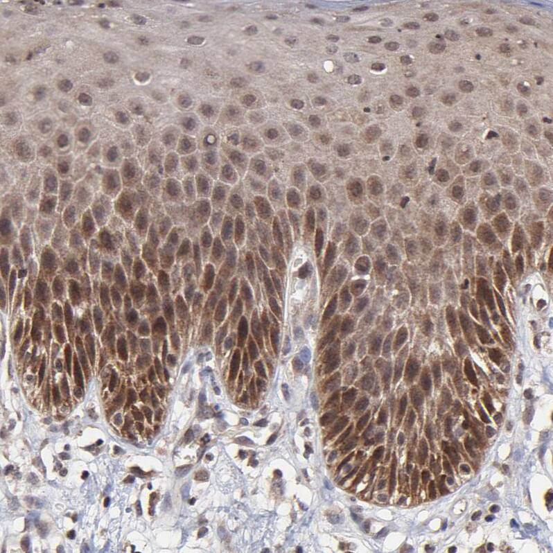 Staining of human skin shows weak nuclear and cytoplasmic positivity in squamous epithelial cells.
