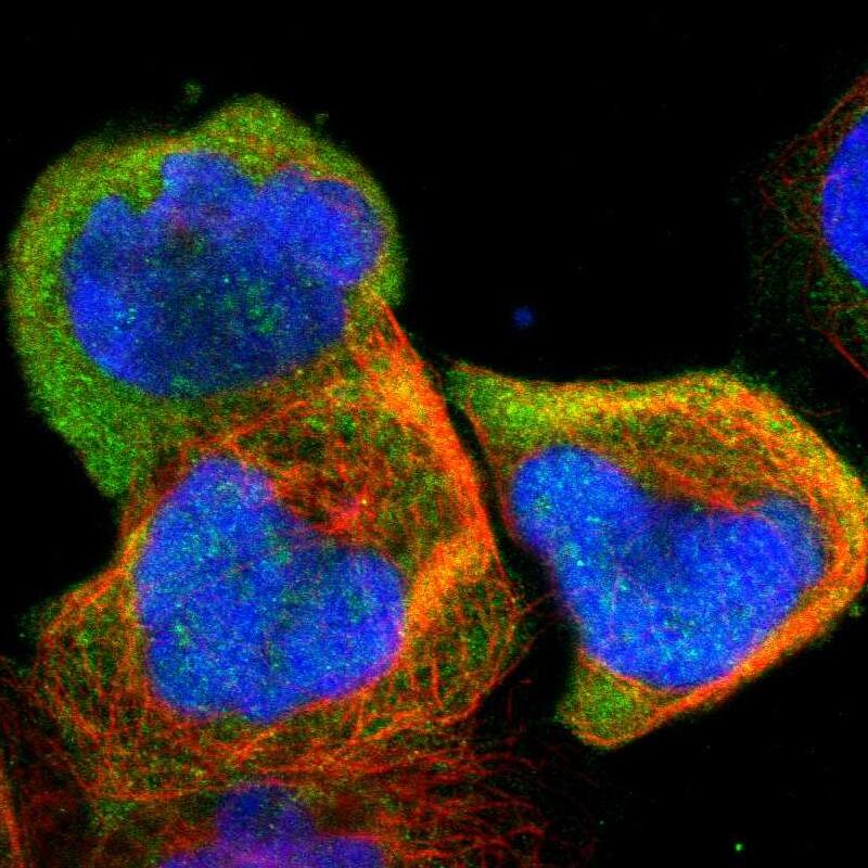 Staining of human cell line A-431 shows localization to cytosol.