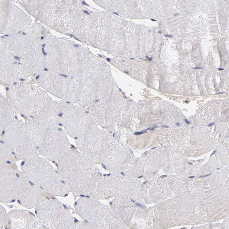 Immunohistochemistry-Paraffin UbcH8/Ube2L6 Antibody - BSA Free