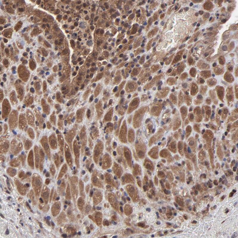 Staining of human placenta shows moderate cytoplasmic positivity in decidual cells.