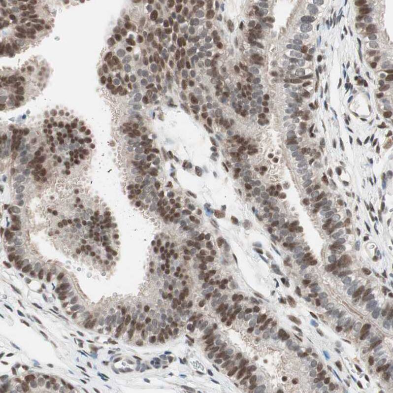 Staining of human fallopian tube shows moderate to strong nuclear positivity in glandular cells.