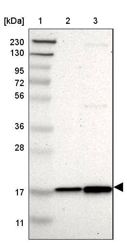 Lane 1: Marker [kDa] 230, 130, 95, 72, 56, 36, 28, 17, 11Lane 2: Human cell line RT-4Lane 3: Human cell line U-251MG sp