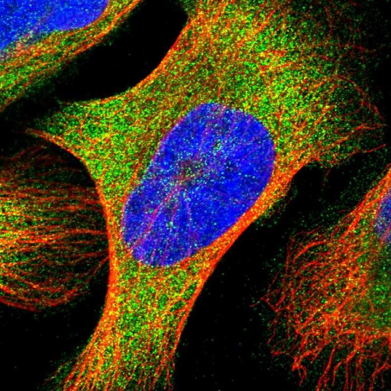 Immunocytochemistry/ Immunofluorescence YARS Antibody - BSA Free