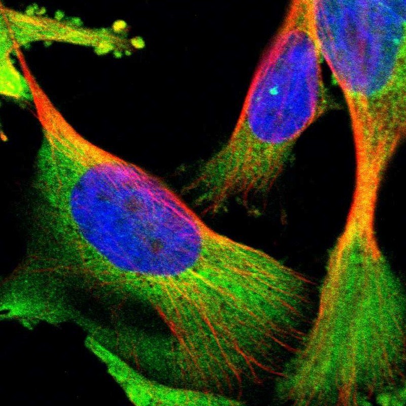 Immunocytochemistry/ Immunofluorescence YARS Antibody - BSA Free