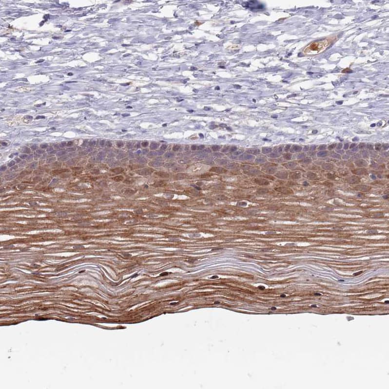 Immunohistochemistry-Paraffin TYW1 Antibody