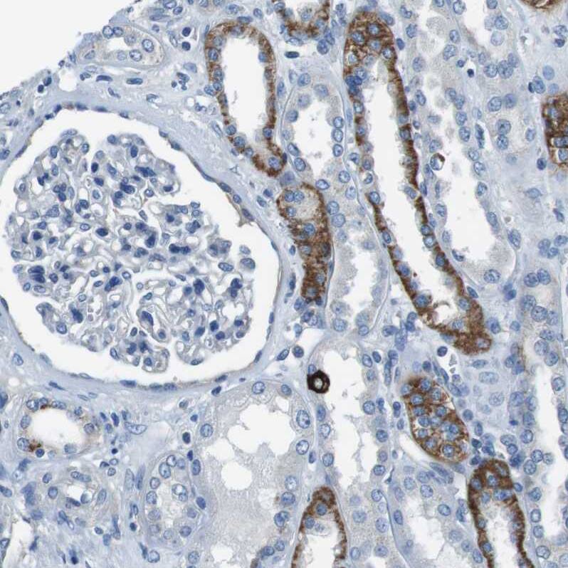 Staining of human kidney shows moderate cytoplasmic positivity in cells in distal tubules.