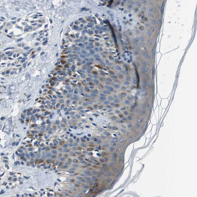 Staining of human skin shows cytoplasmic positivity in squamous epithelial cells.