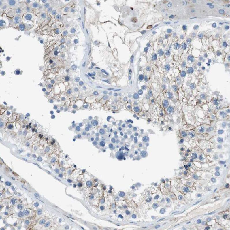 Staining of human testis shows moderate membranous positivity in cells in seminiferous ducts.