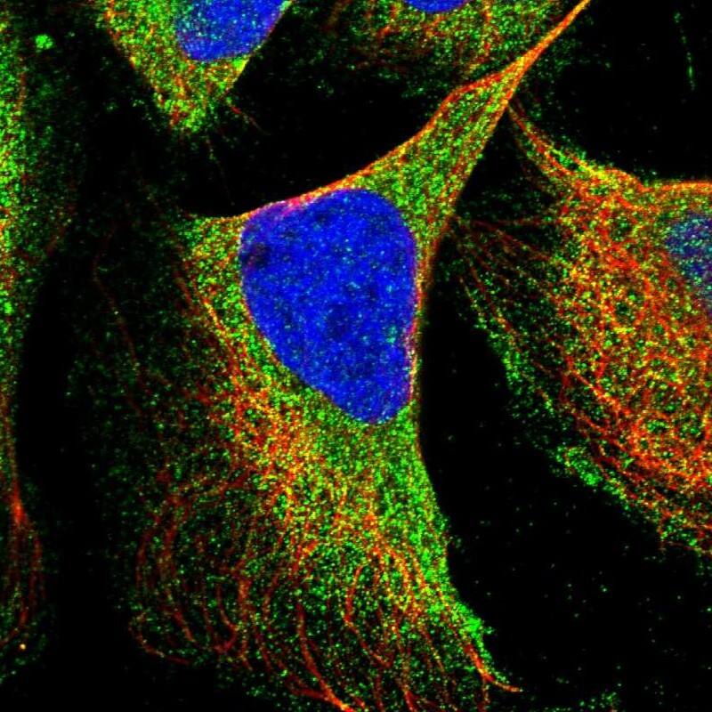 Staining of human cell line U-2 OS shows localization to cytosol.