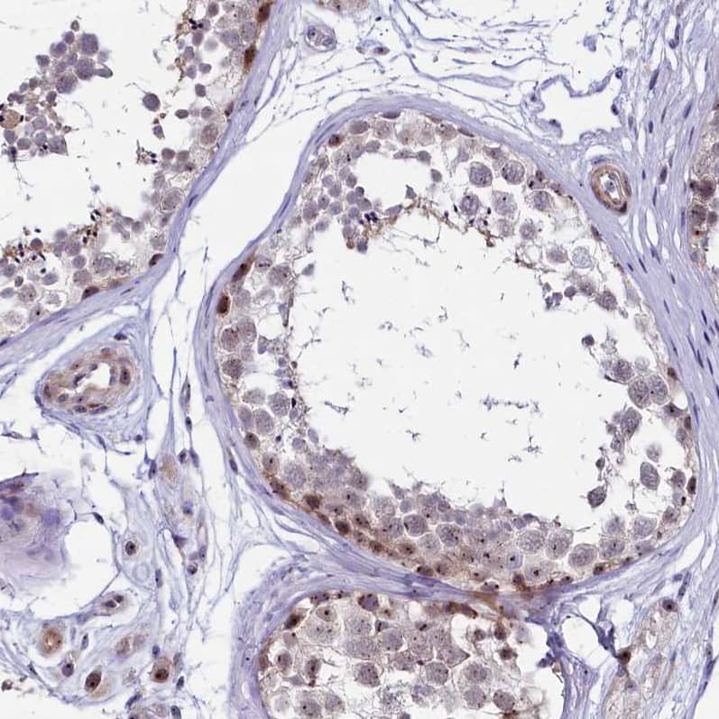Immunohistochemistry-Paraffin Treacher Collins syndrome protein Antibody - BSA Free