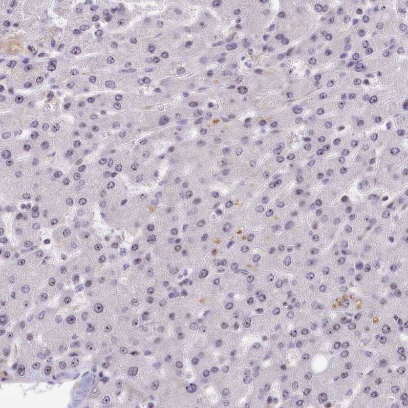 Staining of human liver shows very low positivity in hepatocytes.
