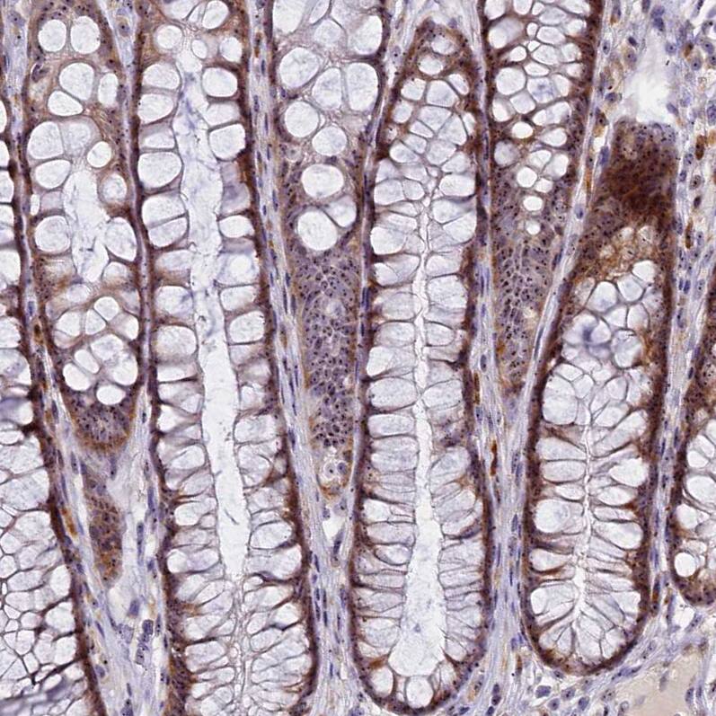 Staining of human rectum shows moderate nuclear and nucleolar positivity in glandular cells.