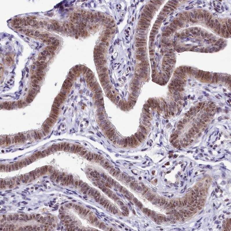 Staining of human Fallopian tube shows moderate nuclear positivity in glandular cells.