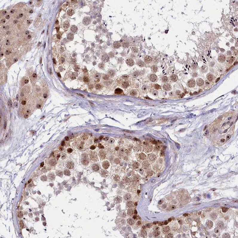 Immunohistochemistry-Paraffin Treacher Collins syndrome protein Antibody - BSA Free