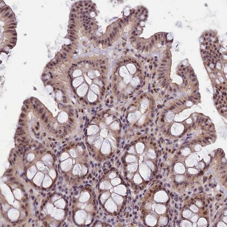 Immunohistochemistry-Paraffin Treacher Collins syndrome protein Antibody - BSA Free