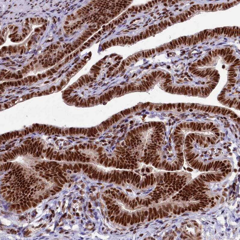 Immunohistochemistry-Paraffin Treacher Collins syndrome protein Antibody - BSA Free