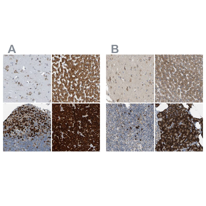 <b>Independent Antibodies Validation. </b>Staining of human cerebral cortex, liver).