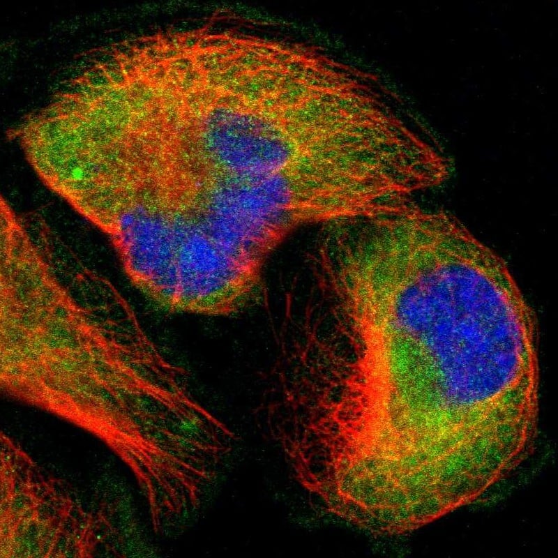 Staining of human cell line U-251 MG shows localization to cytosol.