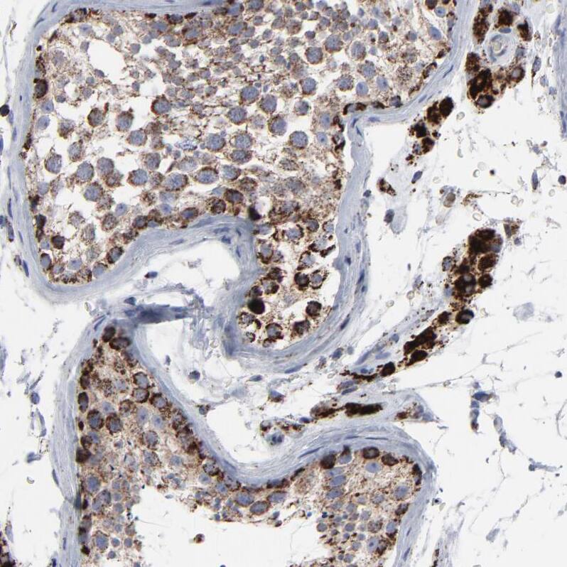 Staining of human testis shows strong granular cytoplasmic positivity in   Spermatogonia and Leydig cells.