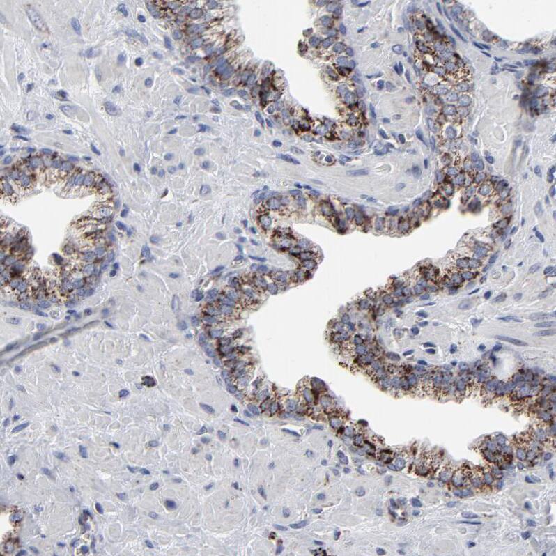 Staining of human prostate shows strong granular cytoplasmic positivity in glandular cells.