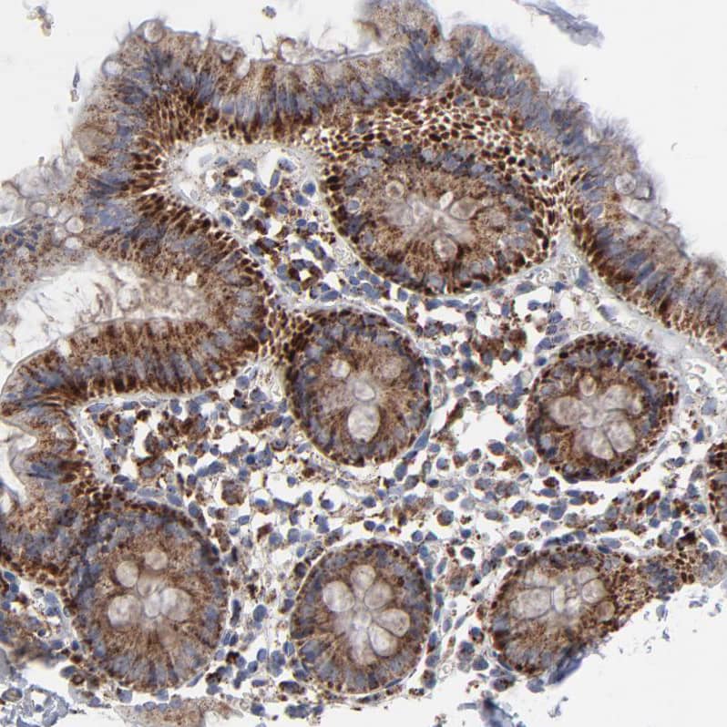 Immunohistochemistry-Paraffin TXNRD2 Antibody - BSA Free