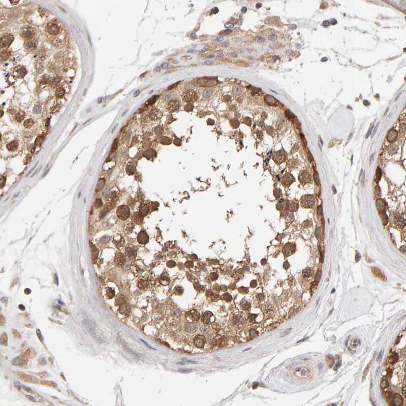 Immunohistochemistry-Paraffin DNAJC7 Antibody - BSA Free