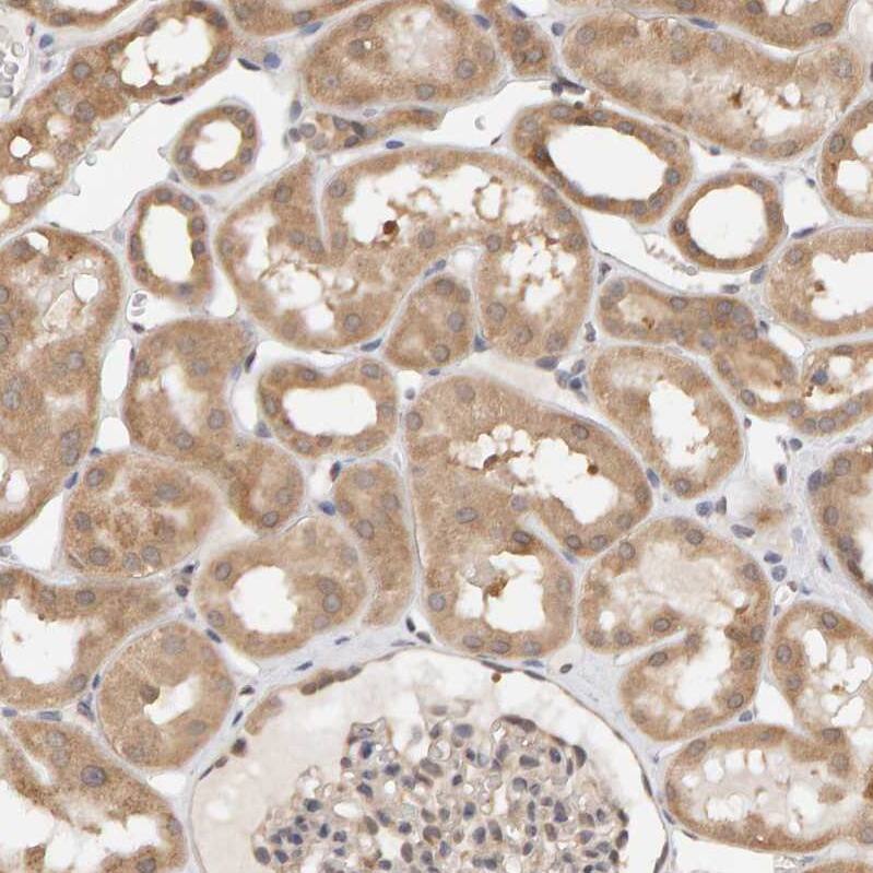 Immunohistochemistry-Paraffin DNAJC7 Antibody - BSA Free