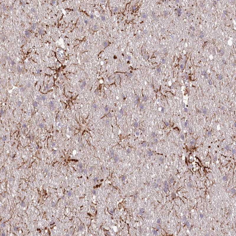 Immunohistochemistry-Paraffin TTC1 Antibody - BSA Free