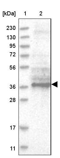 Lane 1: Marker [kDa] 230, 130, 95, 72, 56, 36, 28, 17, 11Lane 2: Human cell line RT-4
