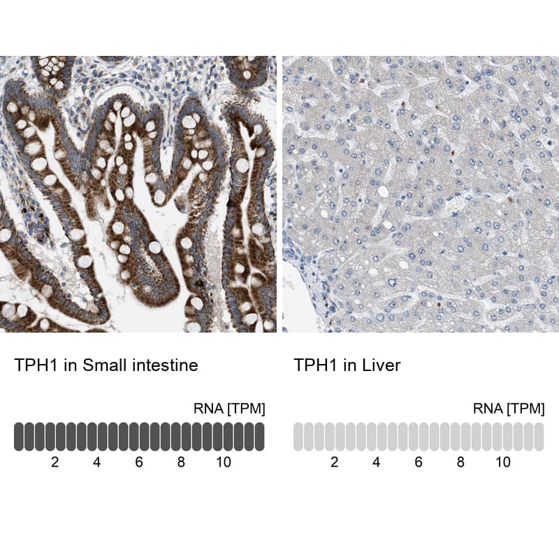 Immunohistochemistry-Paraffin Tryptophan Hydroxylase 1/TPH-1 Antibody - BSA Free