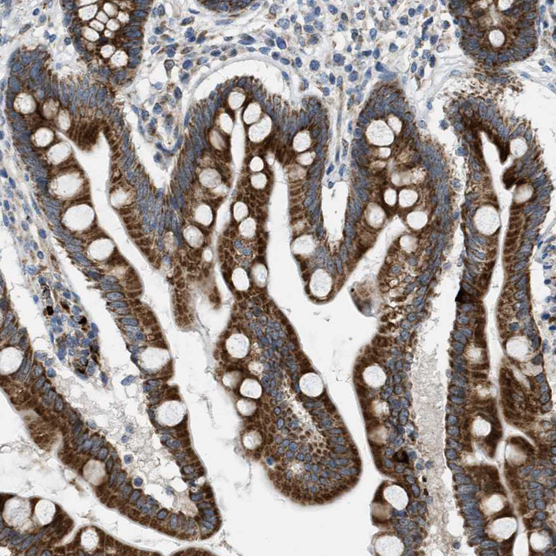 Immunohistochemistry-Paraffin Tryptophan Hydroxylase 1/TPH-1 Antibody - BSA Free