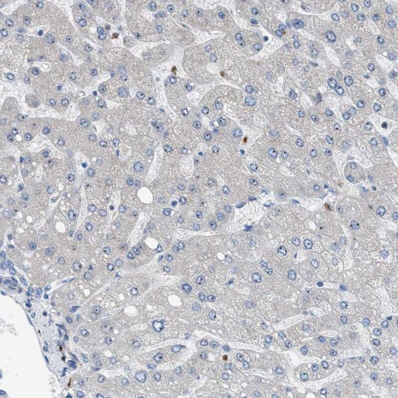 Staining of human liver shows no positivity in hepatocytes as expected.