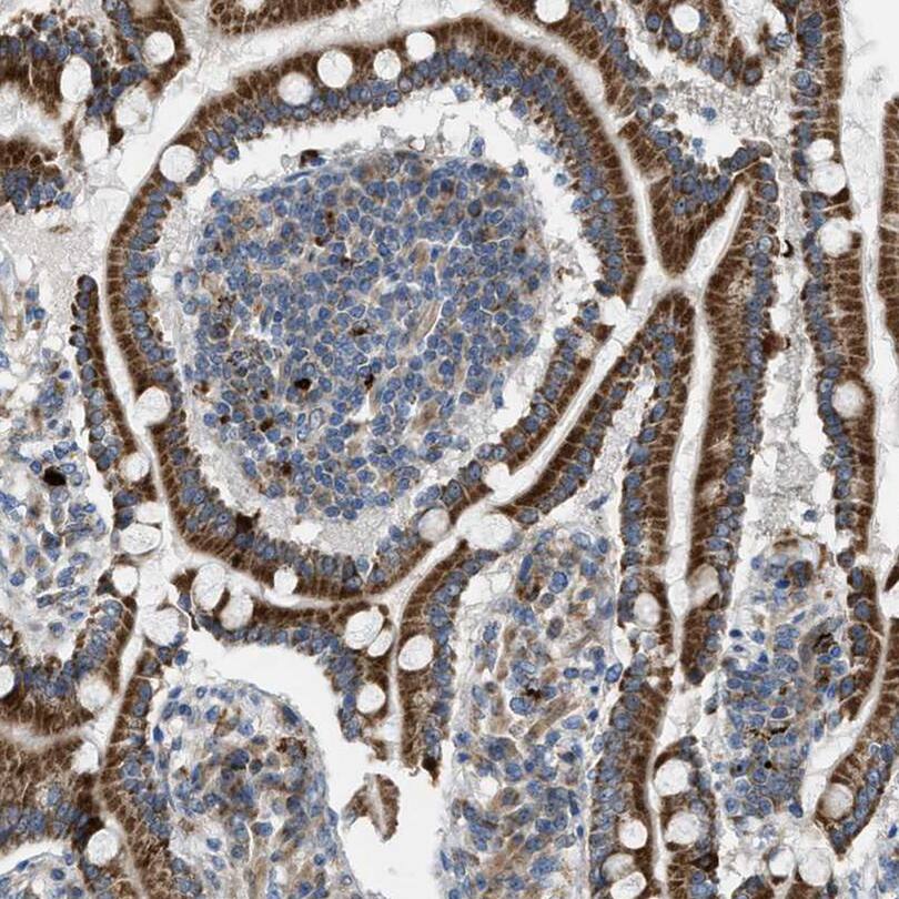 Staining of human duodenum shows moderate to strong cytoplasmic positivity in glandular cells.
