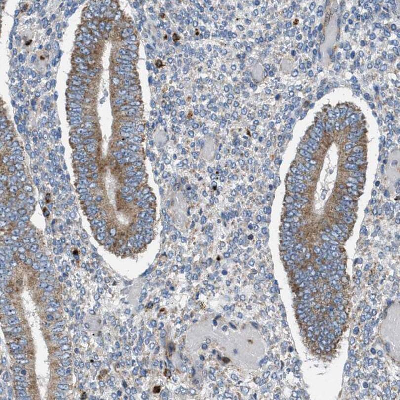 Staining of human endometrium shows moderate cytoplasmic positivity in glandular cells.